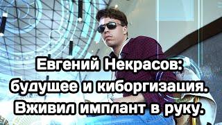 Евгений Некрасов: будущее и киборгизация. Вживил имплант в руку.